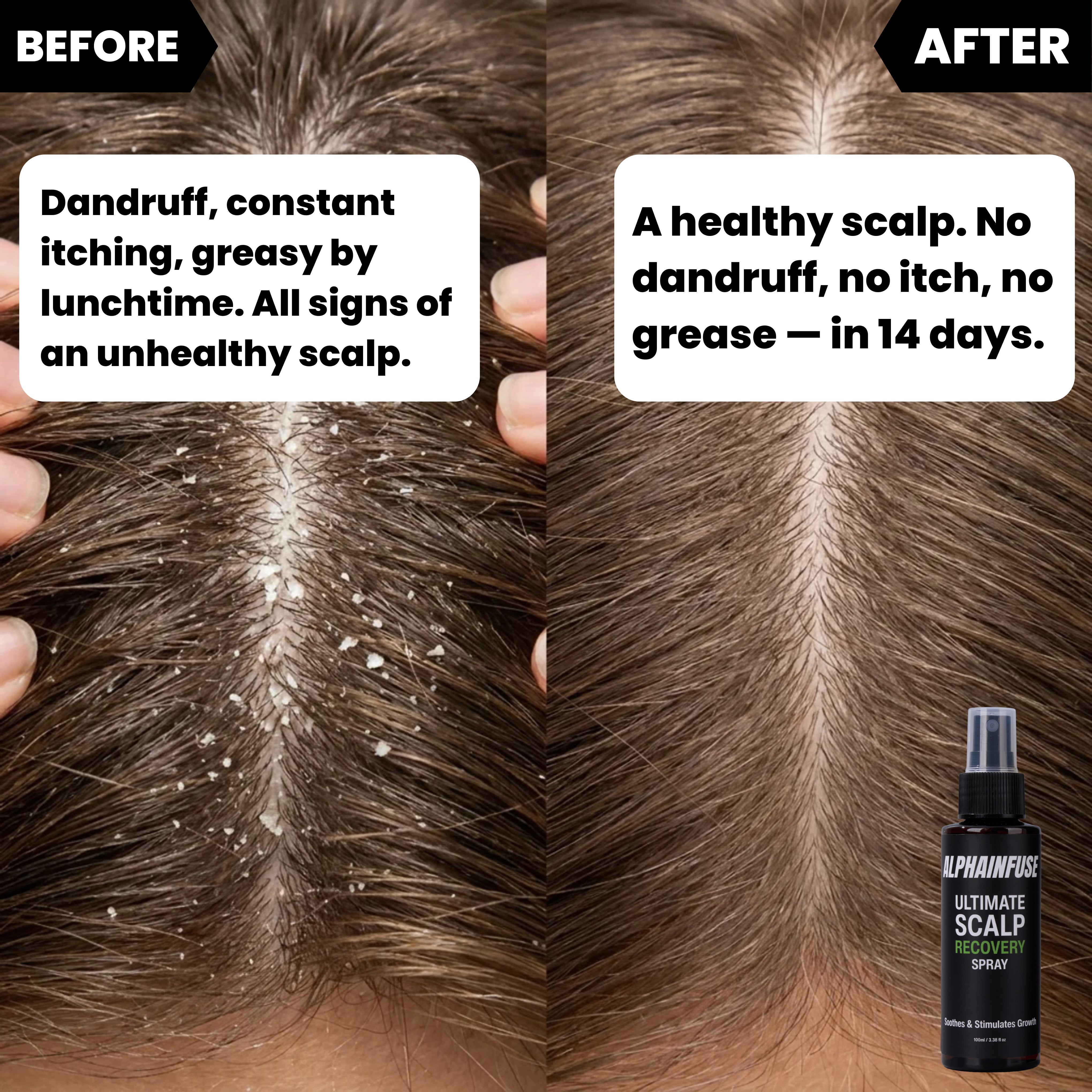 AlphaVance™ Ultimate Scalp Recovery Spray